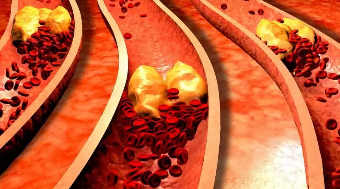 子宫发育异常症状有三 什么原因诱发了此病|xc sports(图3) xc sports
